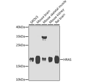 Western Blot - Anti-GTPase HRAS Antibody (A15964) - Antibodies.com