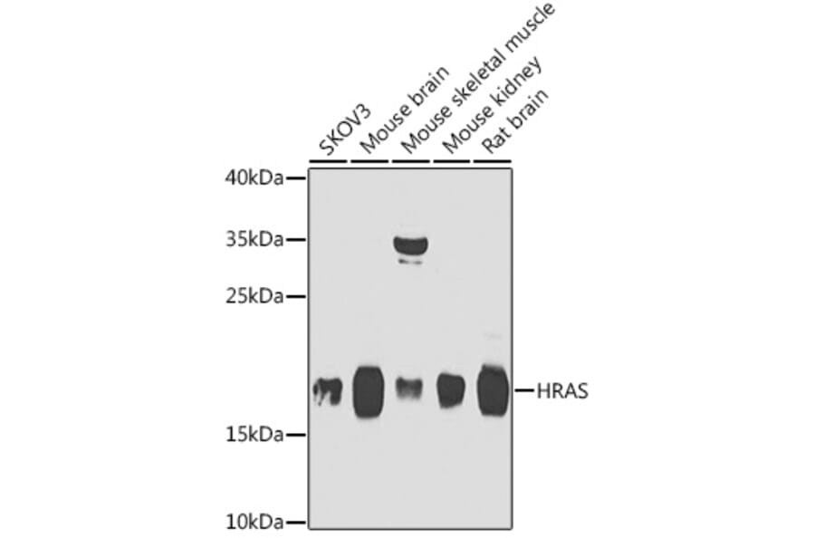 Western Blot - Anti-GTPase HRAS Antibody (A15964) - Antibodies.com