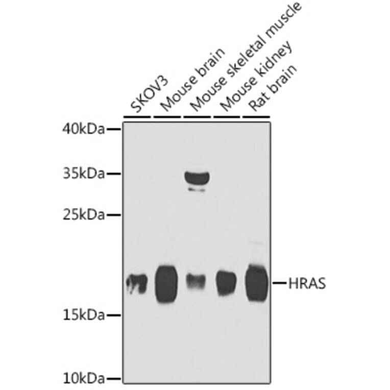 Western Blot - Anti-GTPase HRAS Antibody (A15964) - Antibodies.com
