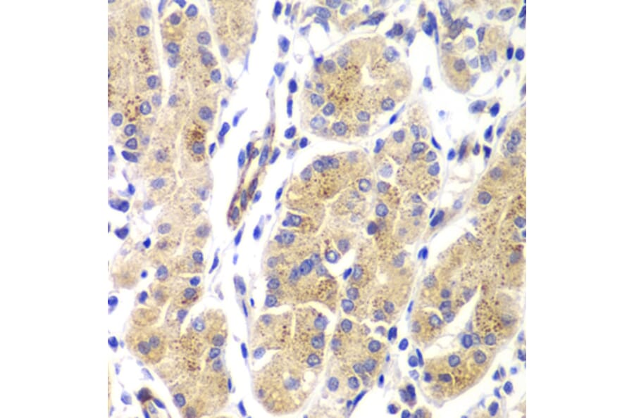 Immunohistochemistry - Anti-GTPase HRAS Antibody (A15964) - Antibodies.com