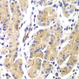 Immunohistochemistry - Anti-GTPase HRAS Antibody (A15964) - Antibodies.com