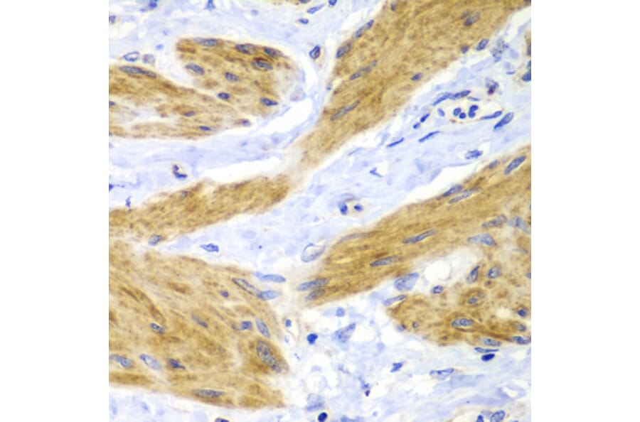 Immunohistochemistry - Anti-GTPase HRAS Antibody (A15964) - Antibodies.com