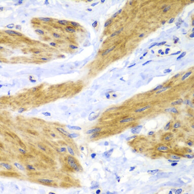 Immunohistochemistry - Anti-GTPase HRAS Antibody (A15964) - Antibodies.com