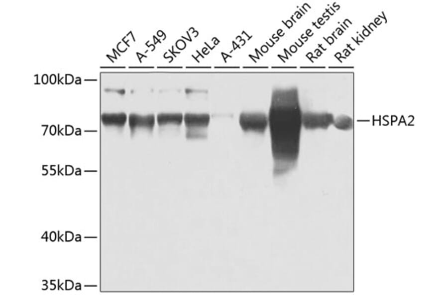Western Blot - Anti-HSPA2 Antibody (A15965) - Antibodies.com