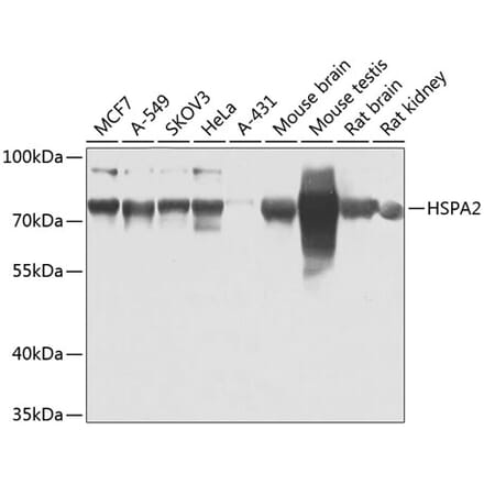 Western Blot - Anti-HSPA2 Antibody (A15965) - Antibodies.com