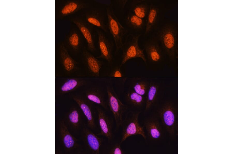 Immunofluorescence - Anti-HSPA2 Antibody (A15965) - Antibodies.com