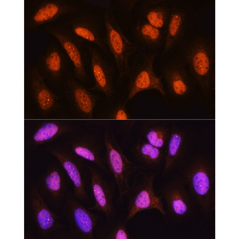 Immunofluorescence - Anti-HSPA2 Antibody (A15965) - Antibodies.com