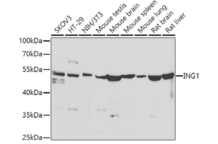 Western Blot - Anti-ING1 Antibody (A15966) - Antibodies.com