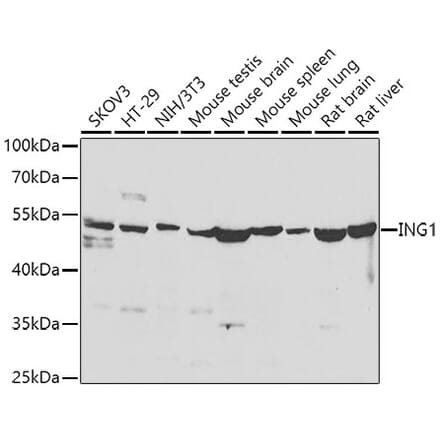 Western Blot - Anti-ING1 Antibody (A15966) - Antibodies.com