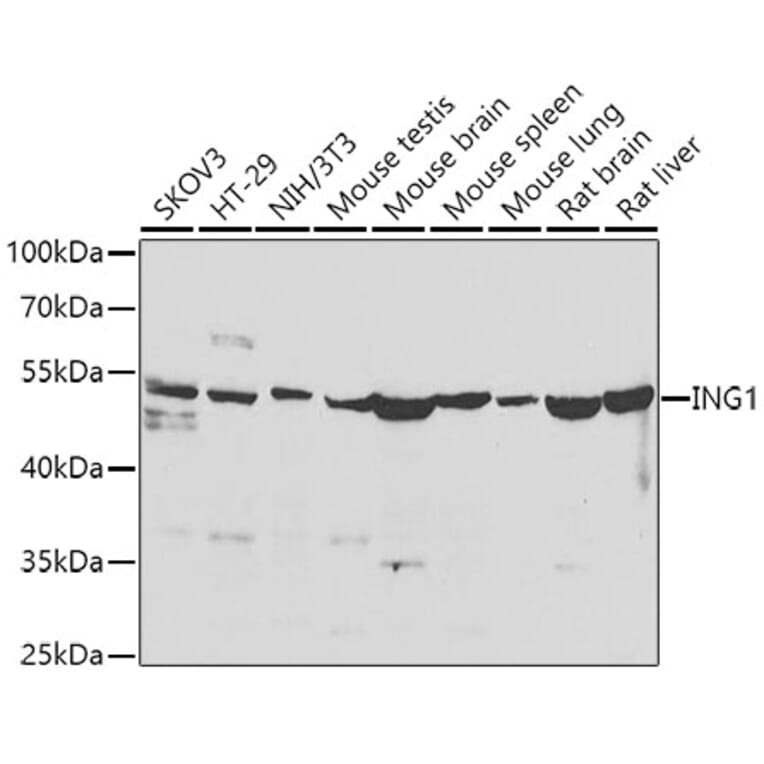 Western Blot - Anti-ING1 Antibody (A15966) - Antibodies.com