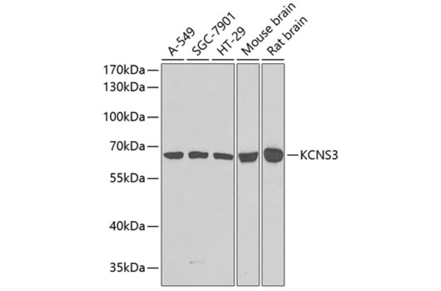 Western Blot - Anti-KCNS3 Antibody (A15967) - Antibodies.com