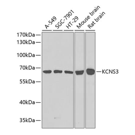 Western Blot - Anti-KCNS3 Antibody (A15967) - Antibodies.com