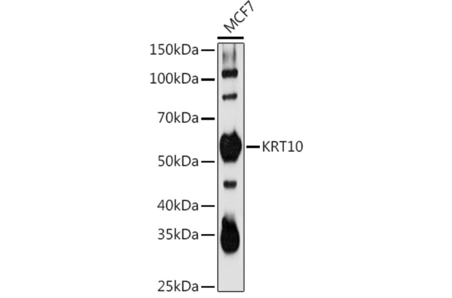 Western Blot - Anti-Cytokeratin 10 Antibody (A15968) - Antibodies.com