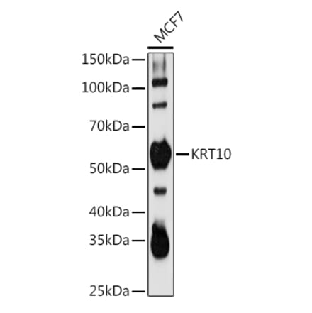 Western Blot - Anti-Cytokeratin 10 Antibody (A15968) - Antibodies.com