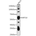 Western Blot - Anti-Cytokeratin 10 Antibody (A15968) - Antibodies.com