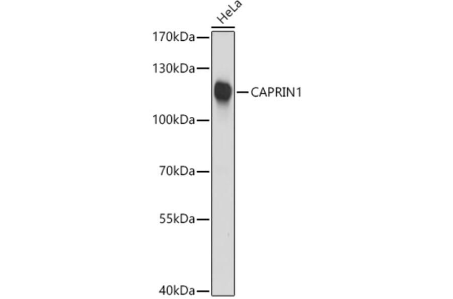 Western Blot - Anti-Caprin-1 Antibody (A15969) - Antibodies.com