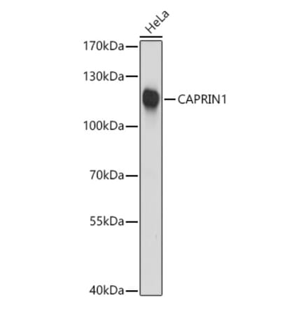 Western Blot - Anti-Caprin-1 Antibody (A15969) - Antibodies.com