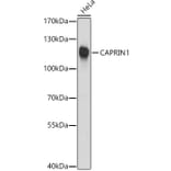 Western Blot - Anti-Caprin-1 Antibody (A15969) - Antibodies.com