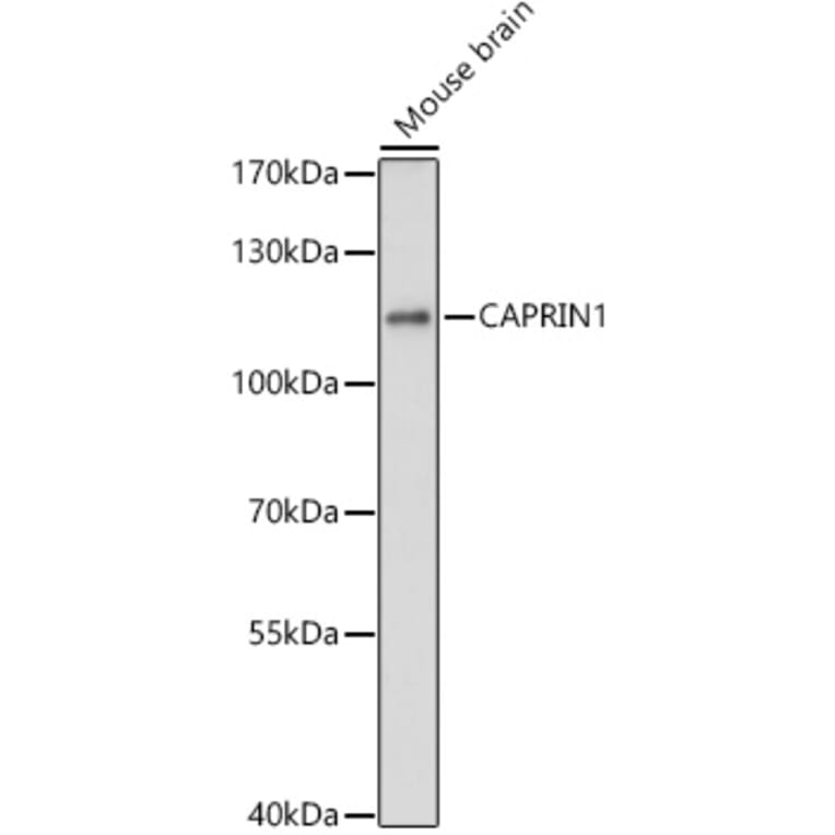 Western Blot - Anti-Caprin-1 Antibody (A15969) - Antibodies.com