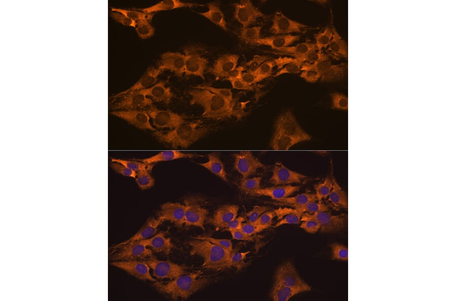 Immunofluorescence - Anti-Caprin-1 Antibody (A15969) - Antibodies.com