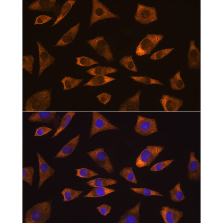 Immunofluorescence - Anti-Caprin-1 Antibody (A15969) - Antibodies.com