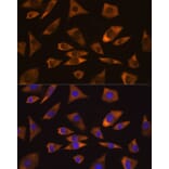 Immunofluorescence - Anti-Caprin-1 Antibody (A15969) - Antibodies.com