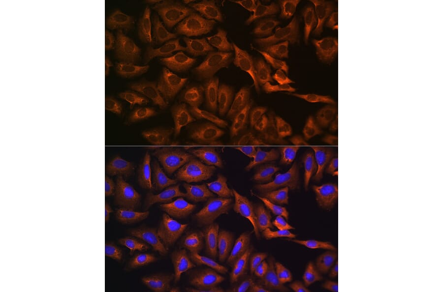 Immunofluorescence - Anti-Caprin-1 Antibody (A15969) - Antibodies.com