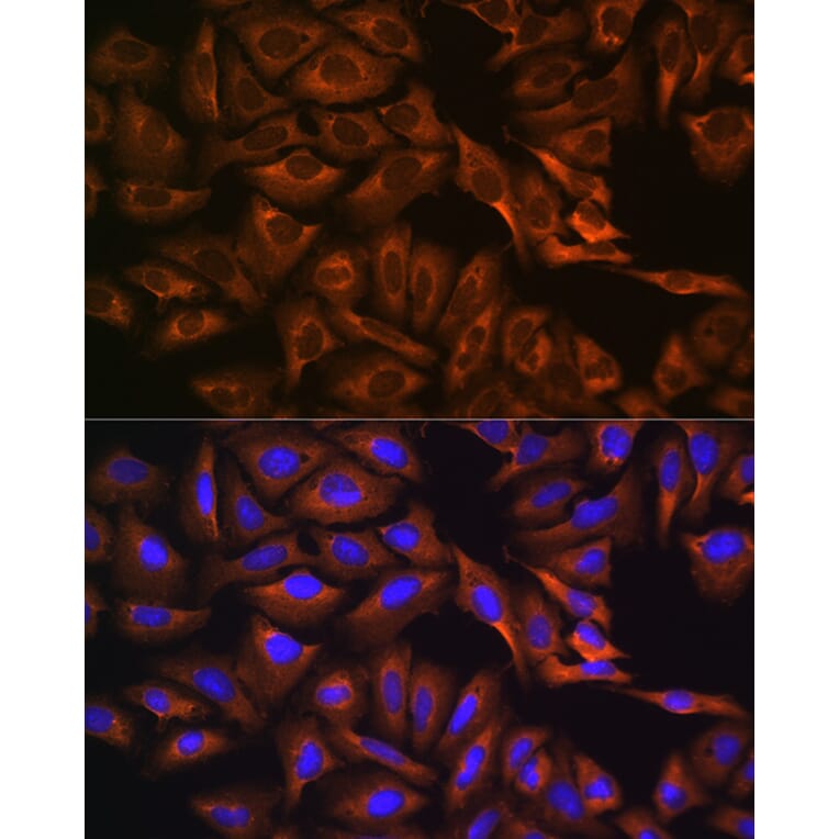 Immunofluorescence - Anti-Caprin-1 Antibody (A15969) - Antibodies.com
