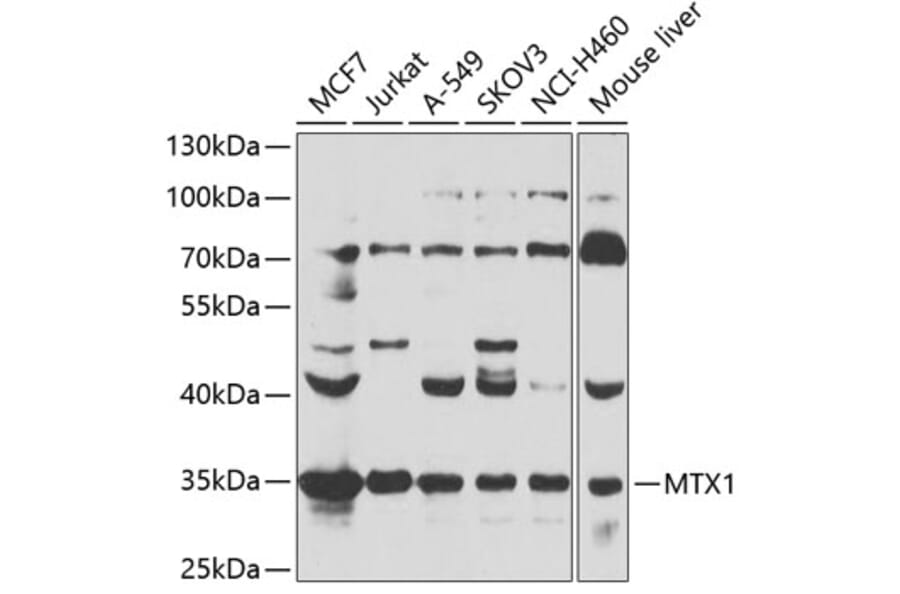 Western Blot - Anti-MTX1 Antibody (A7912) - Antibodies.com