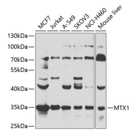 Western Blot - Anti-MTX1 Antibody (A15970) - Antibodies.com