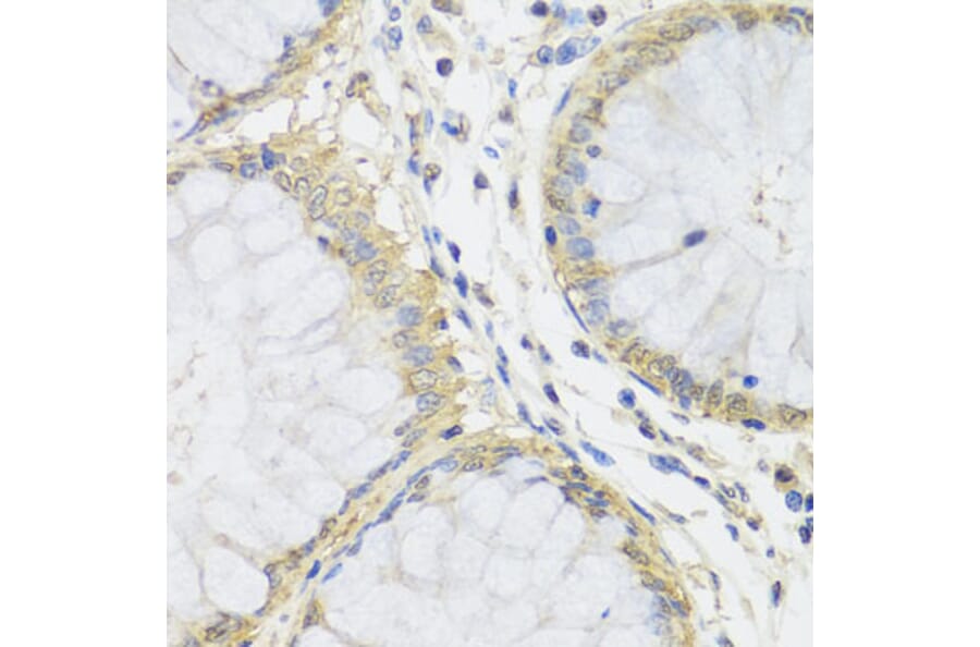 Immunohistochemistry - Anti-MTX1 Antibody (A7912) - Antibodies.com