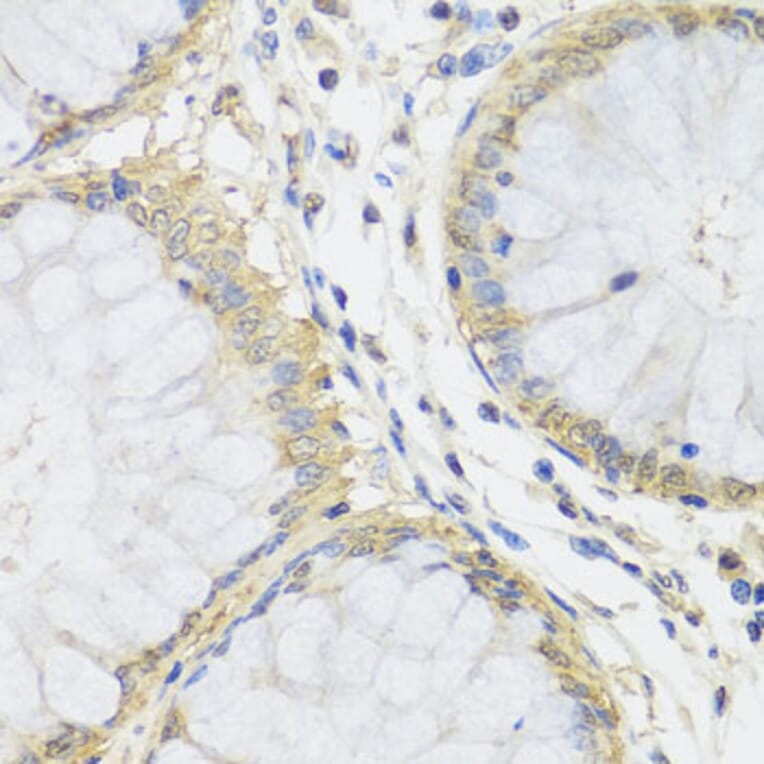 Immunohistochemistry - Anti-MTX1 Antibody (A7912) - Antibodies.com