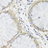 Immunohistochemistry - Anti-MTX1 Antibody (A7912) - Antibodies.com