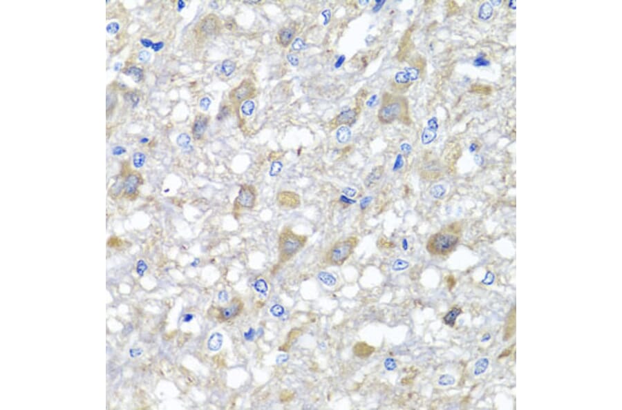 Immunohistochemistry - Anti-MTX1 Antibody (A7912) - Antibodies.com