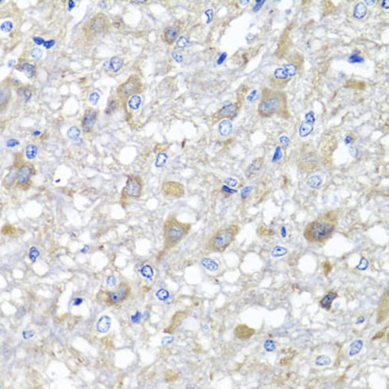 Immunohistochemistry - Anti-MTX1 Antibody (A7912) - Antibodies.com