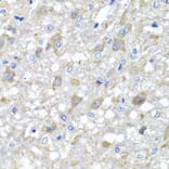 Immunohistochemistry - Anti-MTX1 Antibody (A7912) - Antibodies.com
