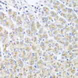 Immunohistochemistry - Anti-MTX1 Antibody (A7912) - Antibodies.com