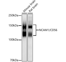 Western Blot - Anti-NCAM1 Antibody (A15971) - Antibodies.com
