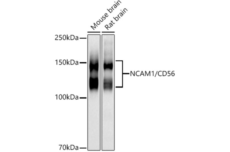 Western Blot - Anti-NCAM1 Antibody (A15971) - Antibodies.com