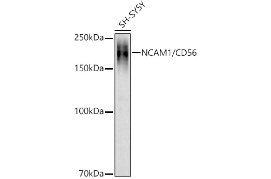 Western Blot - Anti-NCAM1 Antibody (A15971) - Antibodies.com