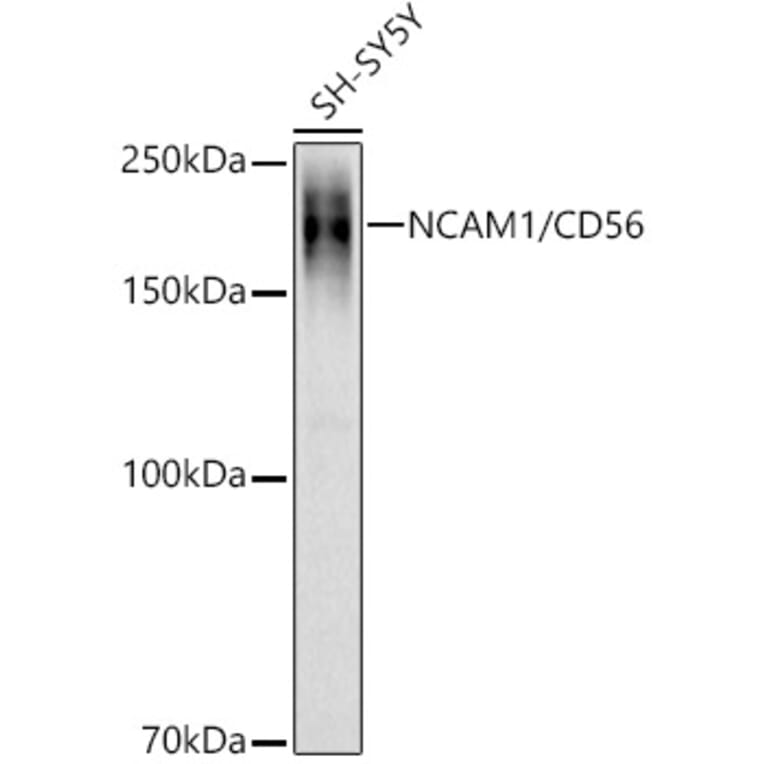 Western Blot - Anti-NCAM1 Antibody (A15971) - Antibodies.com