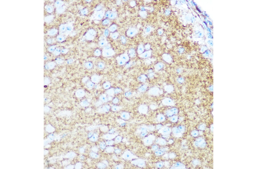 Immunohistochemistry - Anti-NCAM1 Antibody (A15971) - Antibodies.com