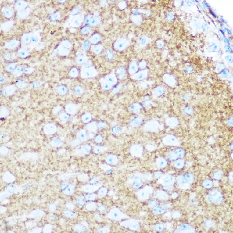 Immunohistochemistry - Anti-NCAM1 Antibody (A15971) - Antibodies.com