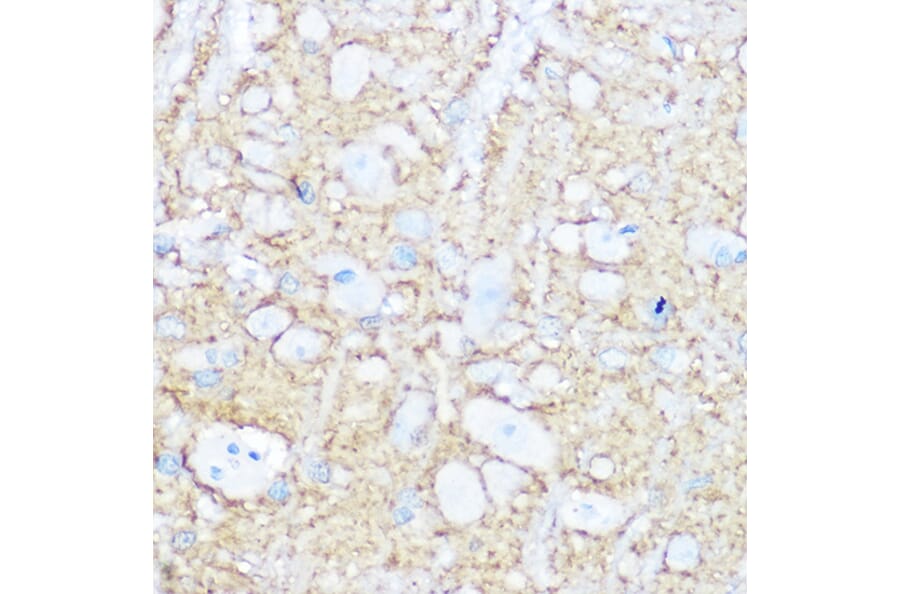 Immunohistochemistry - Anti-NCAM1 Antibody (A15971) - Antibodies.com