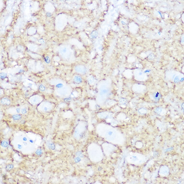 Immunohistochemistry - Anti-NCAM1 Antibody (A15971) - Antibodies.com
