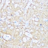 Immunohistochemistry - Anti-NCAM1 Antibody (A15971) - Antibodies.com