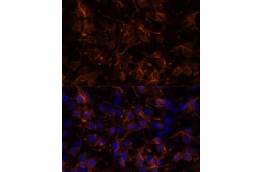Immunofluorescence - Anti-NCAM1 Antibody (A15971) - Antibodies.com