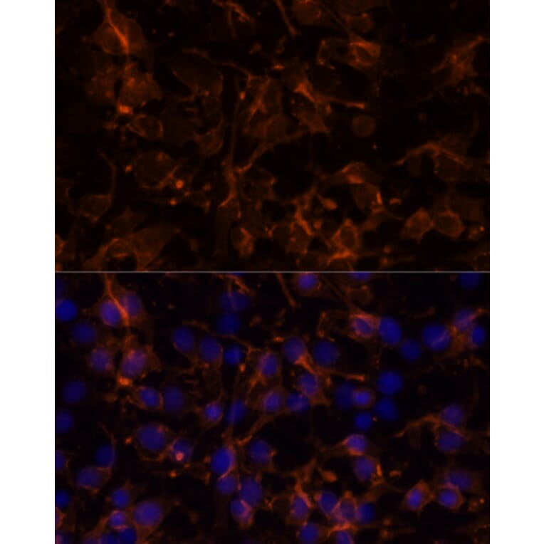 Immunofluorescence - Anti-NCAM1 Antibody (A15971) - Antibodies.com