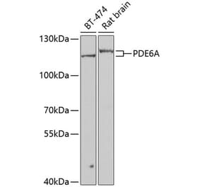 Western Blot - Anti-PDE6 alpha Antibody (A15972) - Antibodies.com