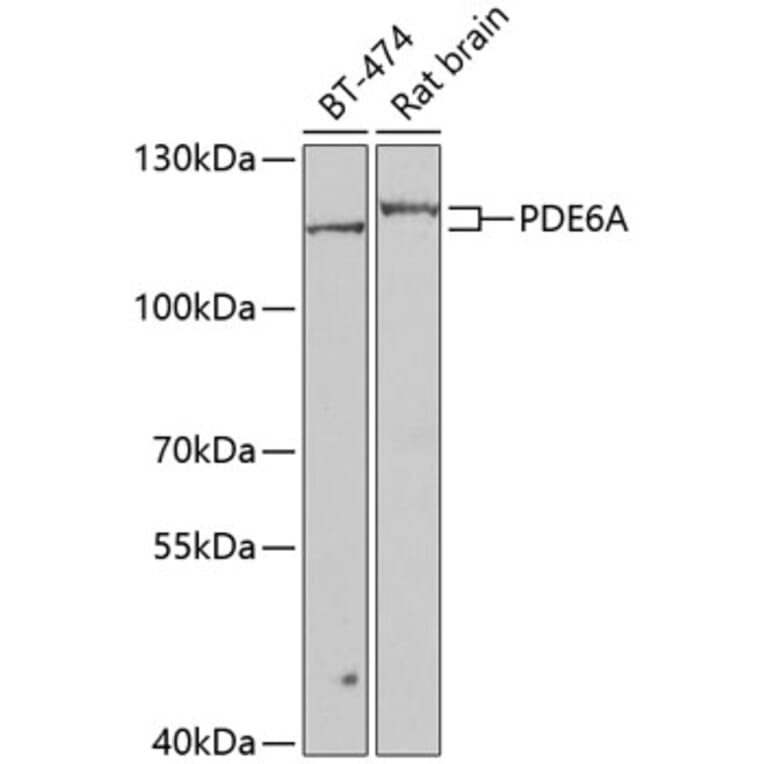 Western Blot - Anti-PDE6 alpha Antibody (A15972) - Antibodies.com